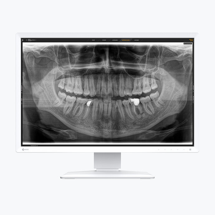 MX243W-DT_1080x1080_Dental.jpg