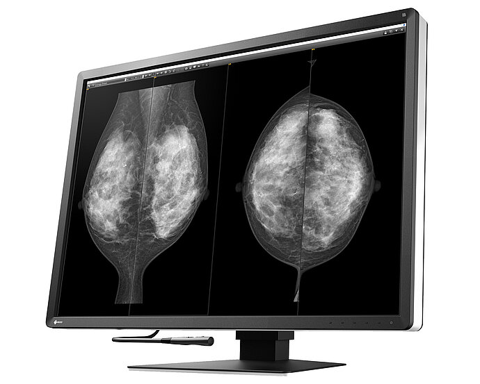 Monitor de informes RX1270 para mamografía digital