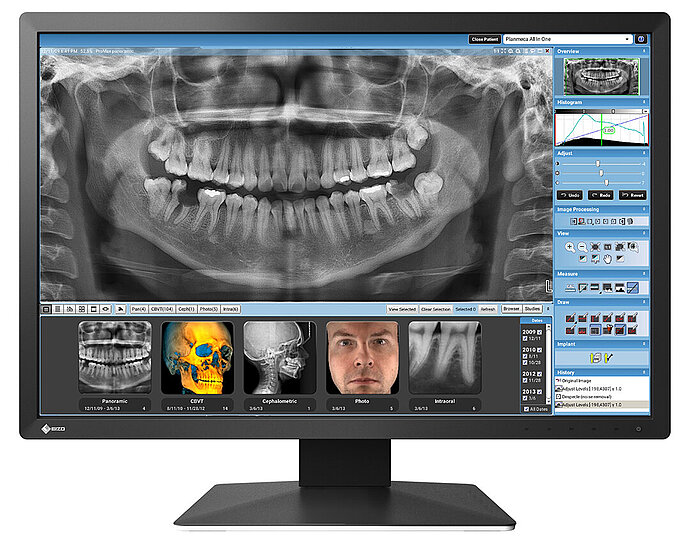 RadiForce_MX243W_dental.jpg