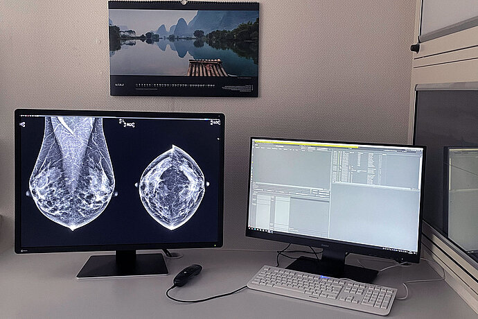 [Translate to Austrian:] Mammografieaufnahme auf dem Monitor